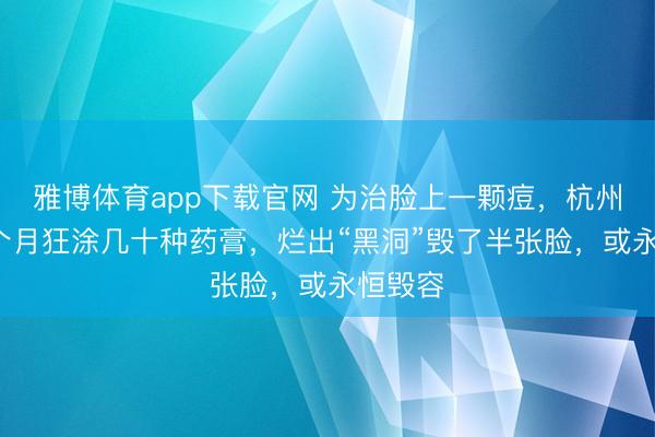 雅博体育app下载官网 为治脸上一颗痘，杭州女子2个月狂涂几十种药膏，烂出“黑洞”毁了半张脸，或永恒毁容